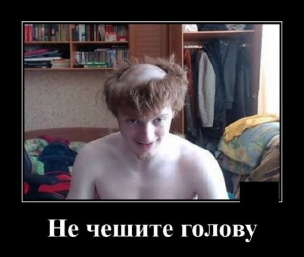 Не чешите голову
