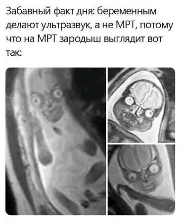 file_103189487