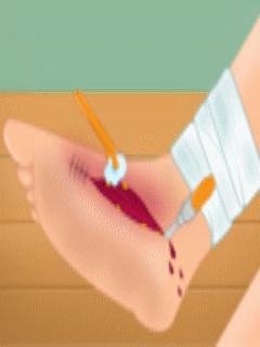 Leg surgery