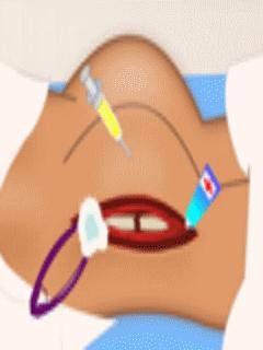 Hip Surgery