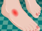 Pedicure After Ankle Surgery