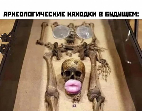 file_93027919