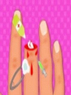 Finger surgery