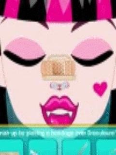 Draculaura Surgery
