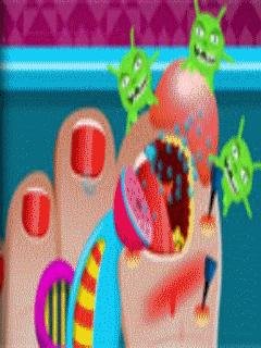 Broken Nail Doctor Care