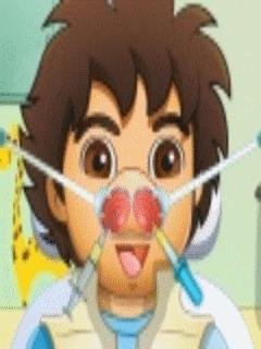 Diego Nose Doctor