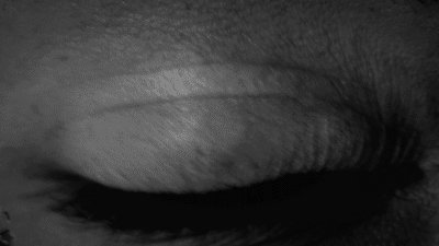 Neobychnyy glaz devushki