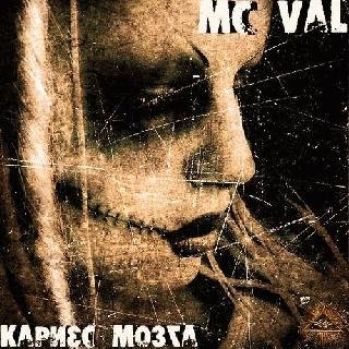 MC Val. Кариес мозга