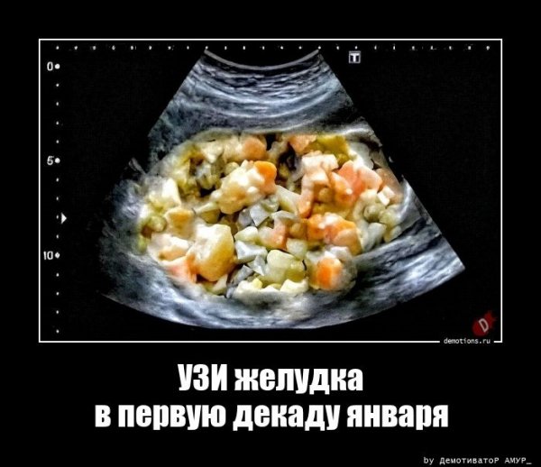 УЗИ желудка в первую декаду января