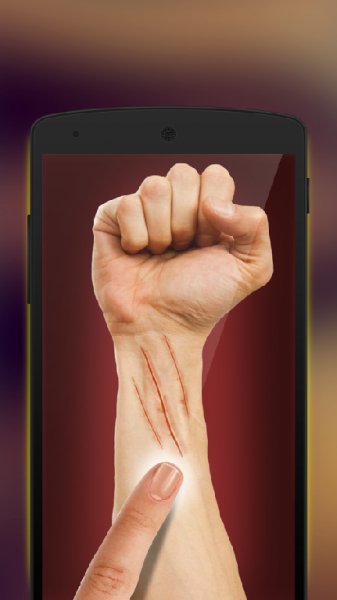 Шрам на теле симулятор v 1.0