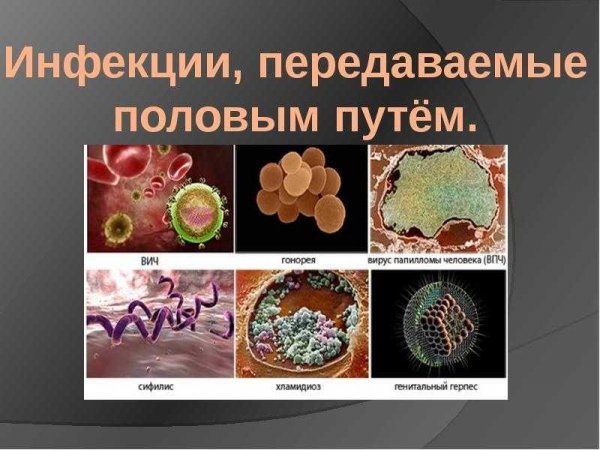 Инфекции, передаваемые половым путем
