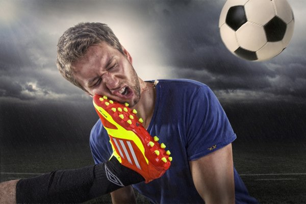 The situation in football 086795