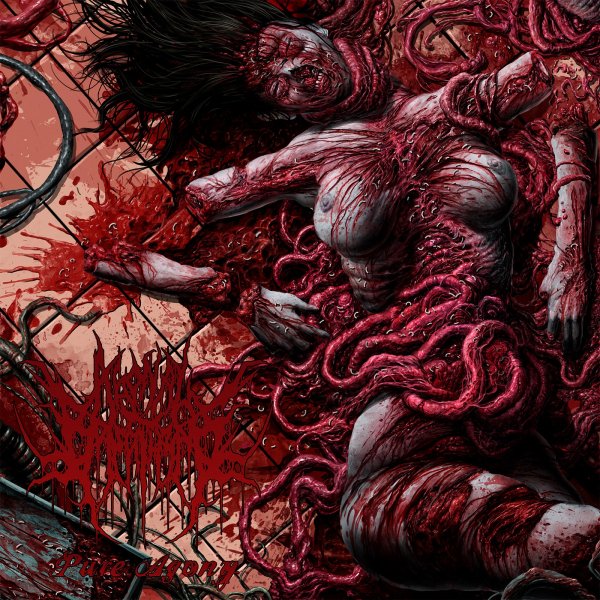 Agonal Breathing - Pure Agony