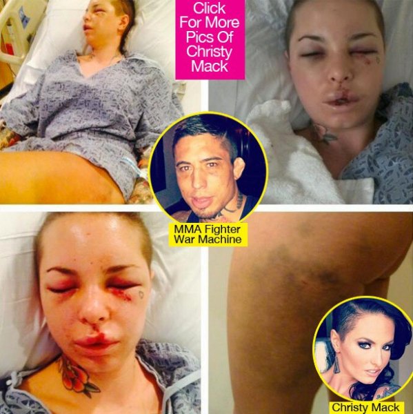 christy-mack-beaut-up-photos-lead