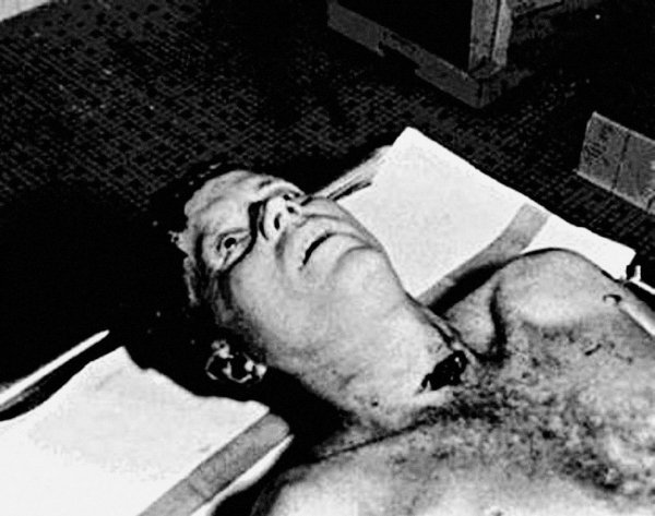 Мертвый президент Кеннеди. 1963 год.