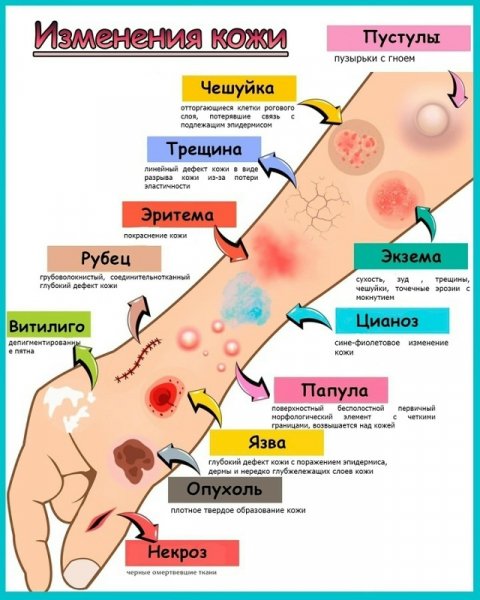 Проблемы на коже